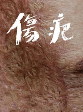 伤疤